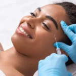 The Science and Art of Achieving Natural Facial Aesthetics with Dermal Fillers